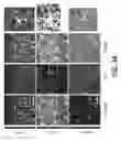 Fig. 35 - Systems and methods for preventing, mitigating, and/or treating dementia
