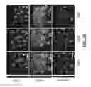 Fig. 37 - Systems and methods for preventing, mitigating, and/or treating dementia
