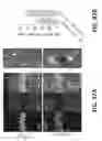 Fig. 43 - Systems and methods for preventing, mitigating, and/or treating dementia