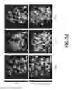 Fig. 52 - Systems and methods for preventing, mitigating, and/or treating dementia