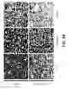 Fig. 65 - Systems and methods for preventing, mitigating, and/or treating dementia