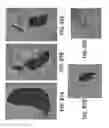 Fig. 88 - Systems and methods for preventing, mitigating, and/or treating dementia
