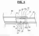 Fig. 04 - Catheter