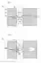 Fig. 06 - Implantable drainage device