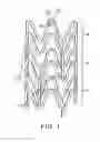 Fig. 02 - Laser system and processing conditions for manufacturing bioabsorbable stents