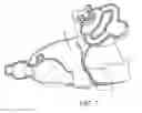 Fig. 07 - Custom elastomeric earmold with secondary material infusion