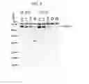 Fig. 06 - IL22 immunoconjugates