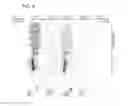 Fig. 08 - IL22 immunoconjugates