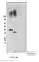 Fig. 45 - Antibodies against OX40 and uses thereof