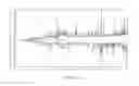 Fig. 09 - Codon optimized polynucleotide for high level expression of CRM197