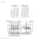 Fig. 02 - Method for manufacturing cis-5-hydroxy-L-pipecolic acid