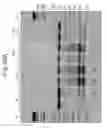 Fig. 48 - Methods for characterizing alternatively or aberrantly spliced mRNA isoforms