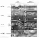 Fig. 09 - Engineered skin equivalent, method of manufacture thereof and products derived therefrom