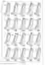 Fig. 07 - Methods and articles relating to ionic liquid bath plating of aluminum-containing layers utilizing shaped consumable aluminum anodes