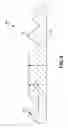 Fig. 04 - Coform Nonwoven Web Containing Expandable Beads