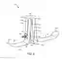 Fig. 03 - Ski device for use with a snow removal device