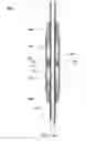 Fig. 06 - System, apparatus and method for artificial lift, and improved downhole actuator for same