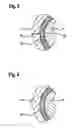 Fig. 04 - Direct injection gas injector with an elastomer seal