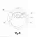 Fig. 10 - INTAKE NOISE REDUCTION DEVICE