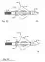 Fig. 04 - METHOD OF MANUFACTURING ARCUATE BLADES FOR A BROADHEAD