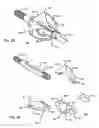 Fig. 06 - METHOD OF MANUFACTURING ARCUATE BLADES FOR A BROADHEAD