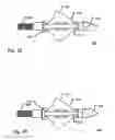 Fig. 12 - METHOD OF MANUFACTURING ARCUATE BLADES FOR A BROADHEAD