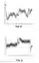 Fig. 08 - Methods for improved heading estimation