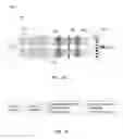 Fig. 08 - Single X-ray grating X-ray differential phase contrast imaging system