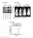 Fig. 16 - Compositions and methods for treating malignancies