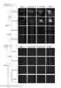 Fig. 20 - Compositions and methods for treating malignancies