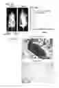 Fig. 23 - Compositions and methods for treating malignancies
