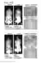 Fig. 30 - Compositions and methods for treating malignancies
