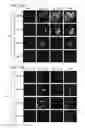 Fig. 35 - Compositions and methods for treating malignancies