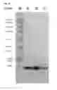 Fig. 33 - Specific and high affinity binding proteins comprising modified SH3 domains of FYN kinase