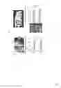 Fig. 03 - Method and a kit to quantify and qualify exosomes for diagnosis of prostate cancer and prostate hyperplasia
