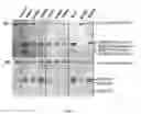 Fig. 04 - METHODS, KITS AND DEVICES FOR DETECTING BII-SPECTRIN, AND BREAKDOWN PRODUCTS THEREOF, AS BIOMARKERS FOR THE DIAGNOSIS OF NEURAL INJURY