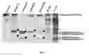 Fig. 09 - METHODS, KITS AND DEVICES FOR DETECTING BII-SPECTRIN, AND BREAKDOWN PRODUCTS THEREOF, AS BIOMARKERS FOR THE DIAGNOSIS OF NEURAL INJURY