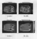 Fig. 16 - Systems and methods for the selective mapping of water T1 relaxation times
