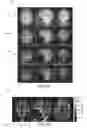Fig. 09 - Silent multi-gradient echo magnetic resonance imaging