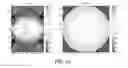 Fig. 11 - Z-SEGMENTED RF COIL FOR MRI WITH GAP AND RF SCREEN ELEMENT