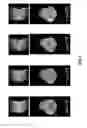 Fig. 07 - 3D UTE imaging using variable-TE stack-of-spirals acquisition