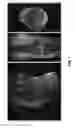 Fig. 08 - 3D UTE imaging using variable-TE stack-of-spirals acquisition