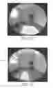Fig. 03 - LIGHT REDIRECTING FILM CONSTRUCTIONS AND METHODS OF MAKING SAME