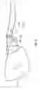 Fig. 35 - Mounting mechanism for eyewear