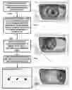 Fig. 01 - PUPILLARY RESPONSE FEEDBACK EYEWEAR