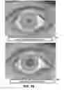 Fig. 32 - PUPILLARY RESPONSE FEEDBACK EYEWEAR