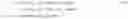 Fig. 07 - Determination of stack difference and correction using stack difference