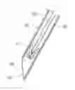Fig. 01 - Body Lumen Occlusion Apparatus and Methods