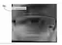 Fig. 01 - Eye contact correction in real time using machine learning