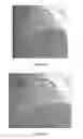 Fig. 10 - METHOD AND SYSTEM FOR PROCESSING AN IMAGE FRAME SHOWING A BIODEGRADABLE MEDICAL DEVICE IN A PART OF A HUMAN BODY